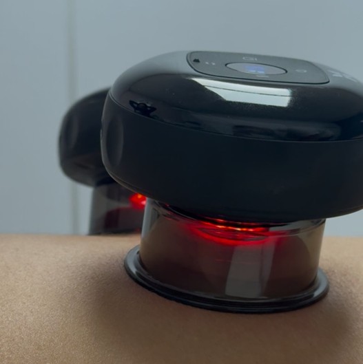 Cupping Therapy